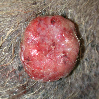 This is one form of cutaneous lymphosarcoma on the side of a dog. This is a malignant cancer affecting lymph cells, which are found throughout your body.